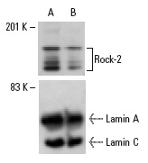 Rock-2 siRNA (h): sc-29474. Western blot analysis of Rock-2 expression in non-transfected control (A) and Rock-2 siRNA transfected (B) HeLa cells. Blot probed with Rock-2 (C-20): sc-1851. Lamin A/C (H-110): sc-20681 used as specificity and loading control.