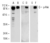 Western blot analysis of λ phosphatase-treated (A,C,E) and untreated (B,D,F) active human recombinant Rsk. Antibodies tested include Rsk-1 (C-21): sc-231 (A,B), p-Rsk (Ser 376): sc-12883 (C,D) and p-Rsk (Ser 376)-R: sc-12883-R (E,F).