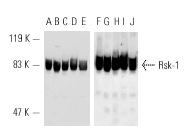 Western blot analysis of Rsk-1 expression in MDCK (A,F), Mv 1 Lu (B,G), A-431 (C,H), HeLa (D,I) and MCF7 (E,J) whole cell lysates. Antibodies tested include Rsk-1 (C-21): sc-231 (A-E) and Rsk-1 (C-21)-G: sc-231-G (F-J).
