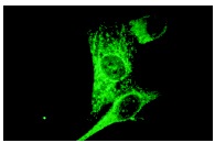 Rsk-1 (C-21): sc-231. Cytoplasmic immunofluorescence staining of methanol-fixed NIH/3T3 cells.