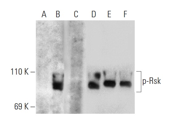 Western blot analysis of Rsk phosphorylation in untreated (A,D), serum-starved, PMA-treated (B,E), serum-starved, PMA and lambda protein phosphatase (sc-200312A) treated (C,F) HeLa whole cell lysates. Antibodies tested include p-Rsk (Ser 380)-R: sc-11756-R (A,B,C) and Rsk-1 (C-21): sc-231 (D,E,F).