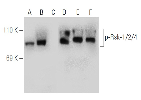Western blot analysis of Rsk phosphorylation in untreated (A,D), serum-starved, PMA-treated (B,E), serum-starved, PMA and lambda protein phosphatase (sc-200312A) treated (C,F) HeLa whole cell lysates. Antibodies tested include p-Rsk-1/2/4 (Ser 363)-R: sc-17033-R (A,B,C) and Rsk-1 (C-21): sc-231 (D,E,F).