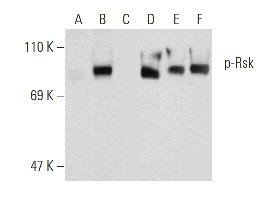Western blot analysis of Rsk phosphorylation in untreated (A,D), serum-starved, PMA-treated (B,E), and serum-starved, PMA and lambda protein phosphatase (sc-200312A) treated (C,F) HeLa whole cell lysates. Antibodies tested include p-Rsk (Thr 359/Ser 363)-R: sc-12898-R (A,B,C) and Rsk-1 (C-21): sc-231 (D,E,F).