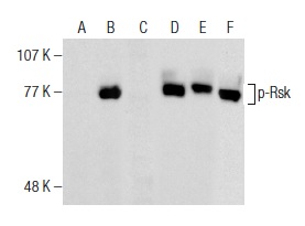 Western blot analysis of Rsk phosphorylation in untreated (A,D), PMA treated (B,E) and PMA and lambda protein phosphatase (sc-200312A) treated (C,F) HeLa whole cell lysates. Antibodies tested include p-Rsk (C-5): sc-377526 (A,B,C) and Ribosomal Rsk-1 (C-21): sc-231 (D,E,F).