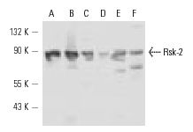 Rsk-2 (C-19)-R: sc-1430-R. Western blot analysis of Rsk-2 expression in A-431 (A), NIH/3T3 (B), HeLa (C), JAR (D), 3611-RF (E) and L8 (F) whole cell lysates.