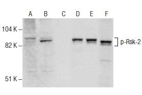 Western blot analysis of Rsk-2 phosphorylation in untreated (A,D), PMA treated (B,E) and PMA and lambda protein phosphatase treated (C,F) HeLa whole cell lysates. Antibodies tested include p-Rsk-2 (C-6): sc-377501 (A,B,C) and Rsk-2 (C-19): sc-1430 (D,E,F).