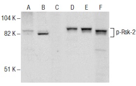 Western blot analysis of Rsk-2 phosphorylation in untreated (A,D), PMA treated (B,E) and PMA and lambda protein phosphatase treated (C,F) HeLa whole cell lysates. Antibodies tested include p-Rsk-2 (F-7): sc-374664 (A,B,C) and Rsk-2 (C-19): sc-1430 (D,E,F).