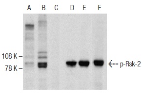 Western blot analysis of Rsk-2 phosphorylation in untreated (A,D), UV treated (B,E) and UV and lambda protein phosphatase (sc-200312A) treated (C,F) NIH/3T3 whole cell lysates. Antibodies tested include p-Rsk-2 (F-7): sc-374664 (A,B,C) and Rsk-2 (C-19): sc-1430 (D,E,F).