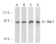 Rsk-2 (C-19): sc-1430. Western blot analysis of Rsk-2 expression in A-431 (A) and NIH/3T3 (B) whole cell lysates. Rsk-2 (C-19)-R: sc-1430-R. Western blot analysis of Rsk-2 expression in A-431 (C), NIH/3T3 (D) whole cell lysates.