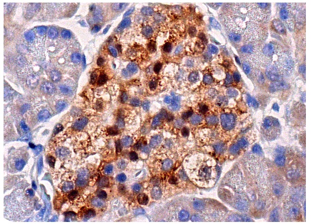 Rsk-2 (C-19): sc-1430. Immunoperoxidase staining of formalin fixed, paraffin-embedded human pancreas tissue showing nuclear and cytoplasmic staining of Islets of Langerhans.