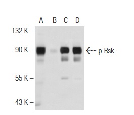 Western blot analysis of Rsk phosphorylation in untreated (A,C) and lambda protein phosphatase treated (B,D) HeLa whole cell lysates. Antibodies tested include p-Rsk (Ser 227)-R: sc-12445-R (A,B) and Rsk-1 (C-21): sc-231 (C,D).