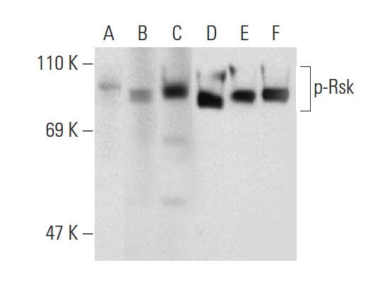 Western blot analysis of Rsk phosphorylation in untreated (A,D), serum-starved, PMA-treated (B,E), and serum-starved, PMA and lambda protein phosphatase (sc-200312A) treated (C,F) HeLa whole cell lysates. Antibodies tested include p-Rsk (Ser 227)-R: sc-12445-R (A,B,C) and Rsk-1 (C-21): sc-231 (D,E,F).