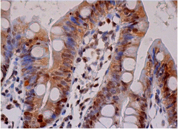 p-Rsk Antibody (Ser 227): sc-12445-R. Immunoperoxidase staining of formalin fixed, paraffin-embedded human small intestine tissue showing nuclear and cytoplasmic staining of glandular cells.