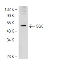 SGK (C-20): sc-15885. Western blot analysis of SGK expression in NIH/3T3 whole cell lysate.