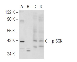 Western blot analysis of SGK phosphorylation in untreated (A,C) and lambda protein phosphatase treated (B,D) HeLa whole cell lysates. Antibodies tested include p-SGK (Thr 256)-R: sc-16744-R (A,B) and SGK (C-20): sc-15885 (C,D).