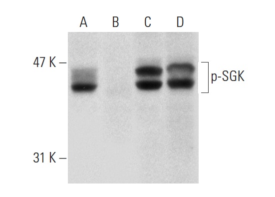 Western blot analysis of SGK phosphorylation in untreated (A,C) and lambda protein phosphatase (sc-200312A) treated (B,D) Hep G2 whole cell lysates. Antibodies tested include p-SGK (Thr 256)-R: sc-16744-R (A,B) and SGK (C-20): sc-15885 (C,D).