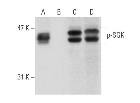 Western blot analysis of SGK phosphorylation in untreated (A,C) and lambda protein phosphatase (sc-200312A) treated (B,D) Hep G2 whole cell lysates. Antibodies tested include p-SGK (Ser 422)-R: sc-16745-R (A,B) and SGK (C-20): sc-15885 (C,D).