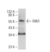 SGK3 (C-6): sc-166847. Western blot analysis of SGK3 expression in A-375 whole cell lysate.