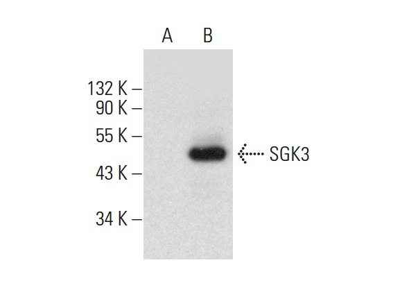 SGK3 (C-6): sc-166847. Western blot analysis of SGK3 expression in non-transfected: sc-117752 (A) and mouse SGK3 transfected: sc-123522 (B) 293T whole cell lysates.