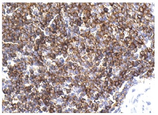 SH-PTP1 (D-11): sc-7289. Immunoperoxidase staining of formalin fixed, paraffin-embedded human spleen tissue showing cytoplasmic staining of cells in white pulp.