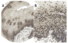 Skip (H-300): sc-30139. Immunoperoxidase staining of formalin fixed, paraffin-embedded human esophagus tissue showing nuclear and cytoplasmic staining of surface epithelial cells at low (A) and high (B) magnification. Kindly provided by The Swedish Human Protein Atlas (HPA) program.