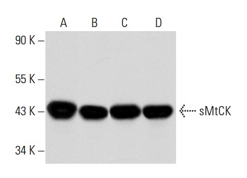 sMtCK (C-18): sc-15168. Western blot analysis of sMtCK expression in rat skeletal muscle (A), mouse skeletal muscle (B), human heart (C) and human skeletal muscle (D) tissue extracts.