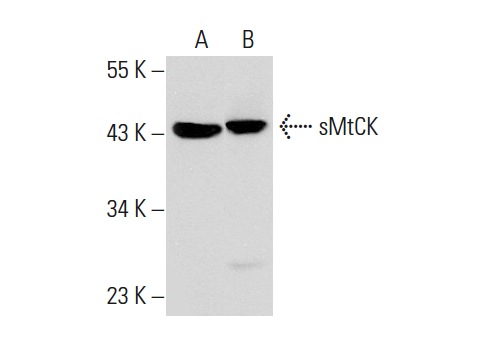 sMtCK (C-18): sc-15168. Western blot analysis of sMtCK expression in NIH/3T3 whole cell lysate (A) and rat brain tissue extract (B).