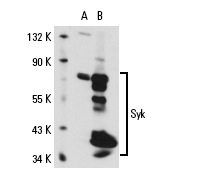 Syk (G-2): sc-28337. Western blot analysis of Syk expression in non-transfected: sc-110760 (A) and human Syk transfected: sc-111124 (B) whole cell lysates.