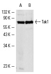 Tak1 (C-9): sc-7967. Western blot analysis of Tak1 expression in HeLa (A) and 3611-RF (B) whole cell lysates.