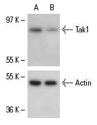 Tak1 siRNA (h): sc-36606. Western blot analysis of Tak1 expression in non-transfected control (A) and Tak1 siRNA transfected (B) HeLa cells. Blot probed with Tak1 (C-9): sc-7967. Actin (I-19): sc-1616 used as specificity and loading control.