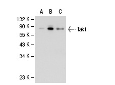Tak1 (C-9): sc-7967. Western blot analysis of Tak1 expression in non-transfected 293: sc-110760 (A), human Tak1 transfected 293: sc-113194 (B) and 3611-RF (C) whole cell lysates.