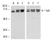 Western blot analysis of Tak1 expression in 3611-RF (A,D), HeLa (B,E) and A-431 (C,F) cell lysates. Antibodies tested include Tak1 (M-17): sc-1839 (A-C) and Tak1 (M-579): sc-7162 (D-F).