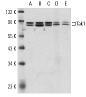 Tak1 (M-17): sc-1839. Western blot analysis of Tak1 expression in HeLa (A), 3611-RF (B) and A-431 (C) whole cell lysates and rat thymus (D) and mouse thymus (E) tissue extracts.