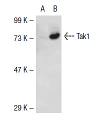 Tak1 (M-17): sc-1839. Western blot analysis of Tak1 expression in non-transfected: sc-117752 (A) and mouse Tak1 transfected: sc-126071 (B) 293T whole cell lysates.