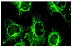 Mcl-1 (S-19): sc-819. Immunofluorescence staining of methanol-fixed BJAB cells showing cytoplasmic localization.