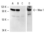Western blot analysis of Wee 1 expression in MOLT-4 (A), BJAB (B,D) and WEHI-231 (C) whole cell lysates. Antibodies tested include Wee 1 (B-11): sc-5285 (A-C) and Wee 1 (H-300): sc-9037 (D).