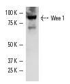Wee 1 (H-300): sc-9037. Western blot analysis of Wee 1 expression in BJAB whole cell lysate.