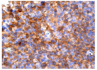 Mcl-1 (G-7): sc-74437. Immunoperoxidase staining of formalin fixed, paraffin-embedded human tonsil tissue showing cytoplasmic staining of cells in germinal and non-germinal centers.