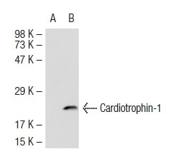 Cardiotrophin-1 (AN-B3): sc-9991. Western blot analysis of Cardiotrophin-1 expression in non-transfected: sc-117752 (A) and mouse Cardiotrophin-1 transfected: sc-126576 (B) 293T whole cell lysates.