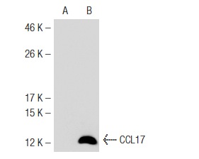 CCL14 (E-5): sc-28388. Western blot analysis of CCL14 expression in non-transfected: sc-117752 (A) and human CCL14 transfected: sc-116022 (B) 293T whole cell lysates.