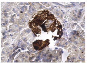 Chr-A (H-300): sc-13090. Immunoperoxidase staining of formalin fixed, paraffin-embedded human pancreas tissue showing cytoplasmic staining of Islets of Langerhans.