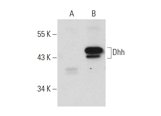 Dhh (F-9): sc-271168. Western blot analysis of Dhh expression in non-transfected: sc-117752 (A) and human Dhh transfected: sc-114457 (B) 293T whole cell lysates.