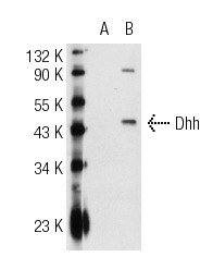 Dhh (N-19): sc-1193. Western blot analysis of Dhh expression in non-transfected: sc-117752 (A) and human Dhh transfected: sc-114457 (B) 293T whole cell lysates.