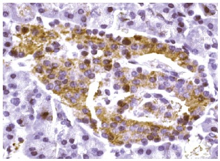 Dhh (N-19): sc-1193. Immunoperoxidase staining of formalin fixed, paraffin-embedded human pancreas tissue showing cytoplasmic staining of islet of langerhans cells.