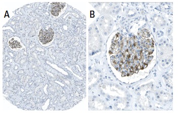 FGF-1 (B-3): sc-55520. Immunoperoxidase staining of formalin fixed, paraffin-embedded human kidney tissue showing cytoplasmic and membrane staining of cells in glomeruli at low (A) and high (B) magnification. Kindly provided by The Swedish Human Protein Atlas (HPA) program.