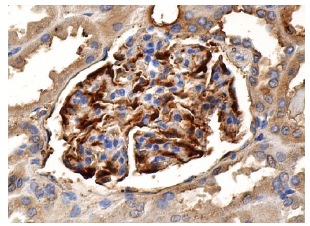 FGF-1 (B-3): sc-55520. Immunoperoxidase staining of formalin fixed, paraffin-embedded human kidney tissue showing cytoplasmic and membrane staining of cells in glomeruli.