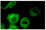 FGF-1 (C-19): sc-1884. Immunofluorescence staining of methanol-fixed ECV304 cells showing cytoplasmic localization.