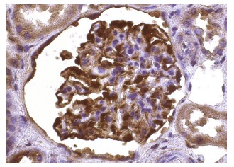 FGF-1 (C-19): sc-1884. Immunoperoxidase staining of formalin fixed, paraffin-embedded human kidney tissue showing strong cytoplasmic staining in a subset of glomerular cells and weak cytoplasmic staining of cells in tubules.