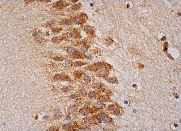 FGF-13 (C-20): sc-16811. Immunoperoxidase staining of formalin fixed, paraffin-embedded human hippocampus tissue showing cytoplasmic staining of neuronal cells and glial cells.