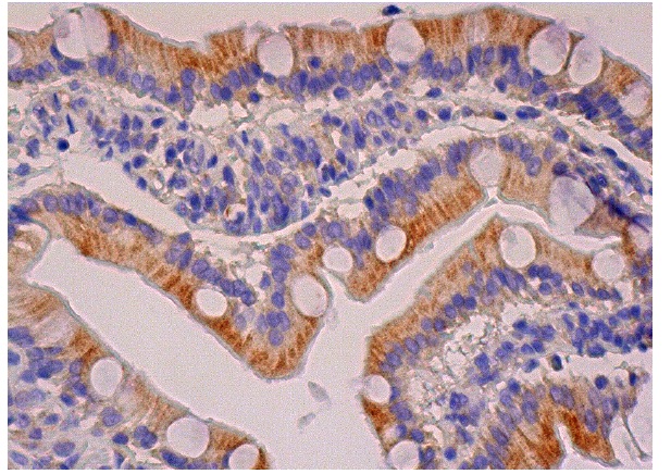 G-CSF (3D1): sc-53292. Immunoperoxidase staining of formalin fixed, paraffin-embedded human duodenum tissue showing cytoplasmic staining of glandular cells.